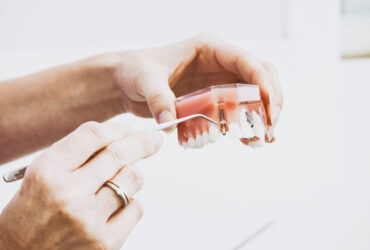 Terapia parodontale