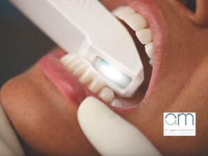 scanner intraorale studio dentistico dr agata lavinia malara rc